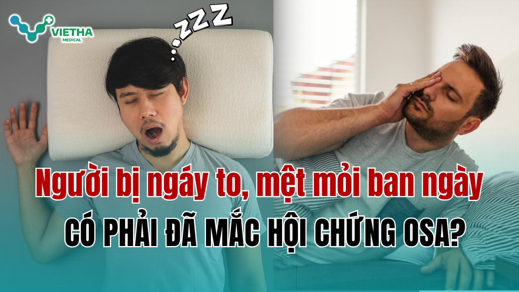 Người bị ngáy to, mệt mỏi ban ngày – có phải đã mắc hội chứng OSA?
