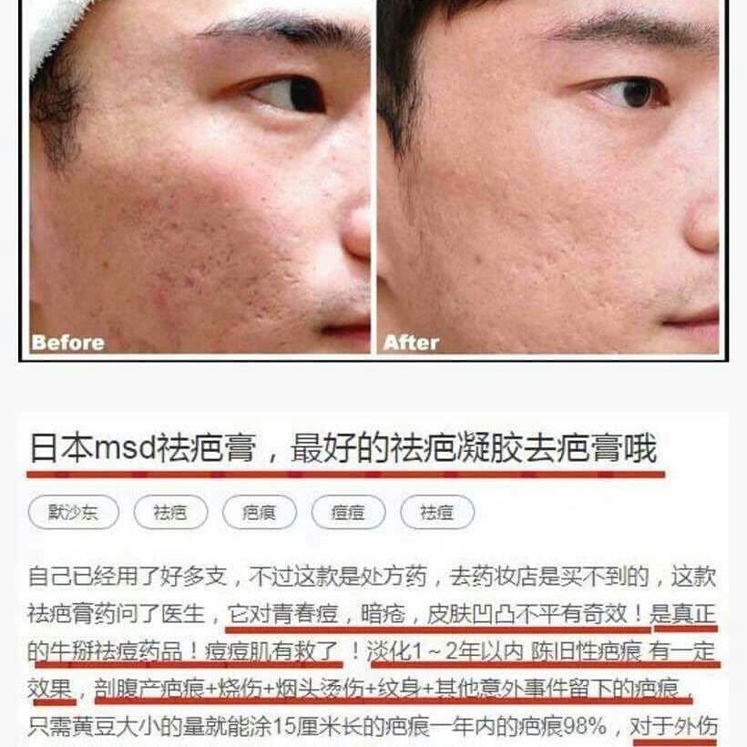 GENTACIN - 6M+KEM TRỊ SẸO NHẬT