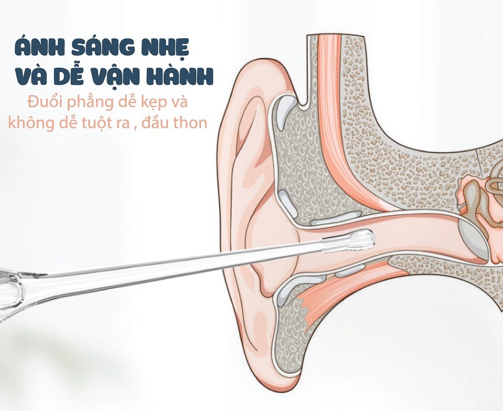 MUDOU - DỤNG CỤ LẤY RÁY TAI CÓ ĐÈN