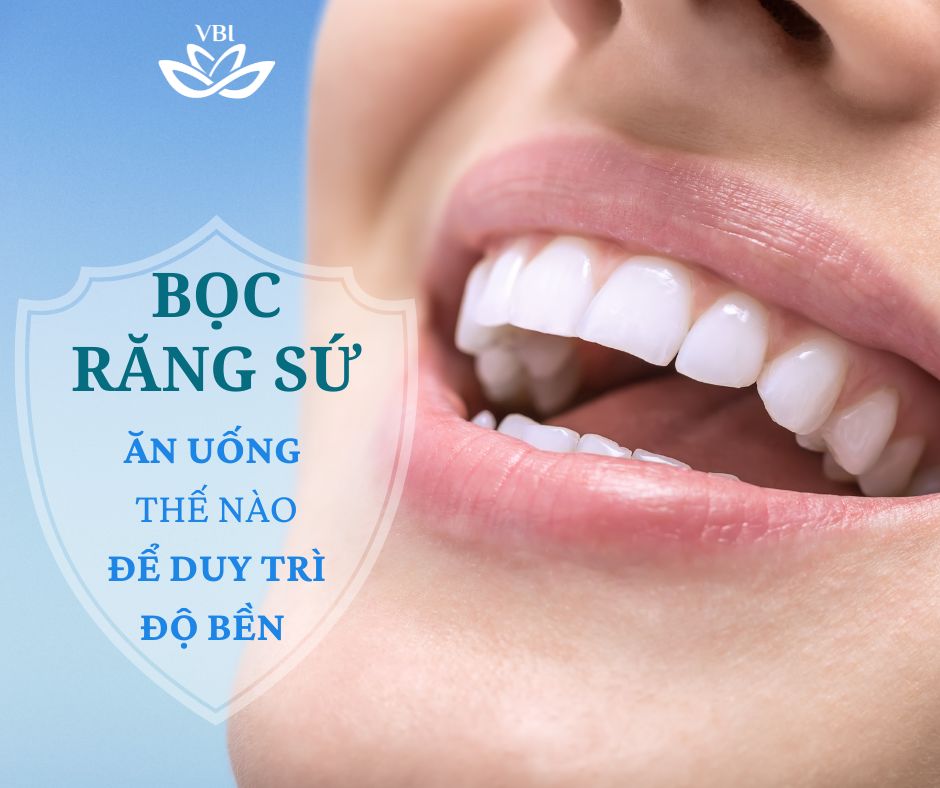 BỌC RĂNG SỨ ĂN UỐNG NHƯ THẾ NÀO ĐỂ RĂNG LUÔN BỀN ĐẸP