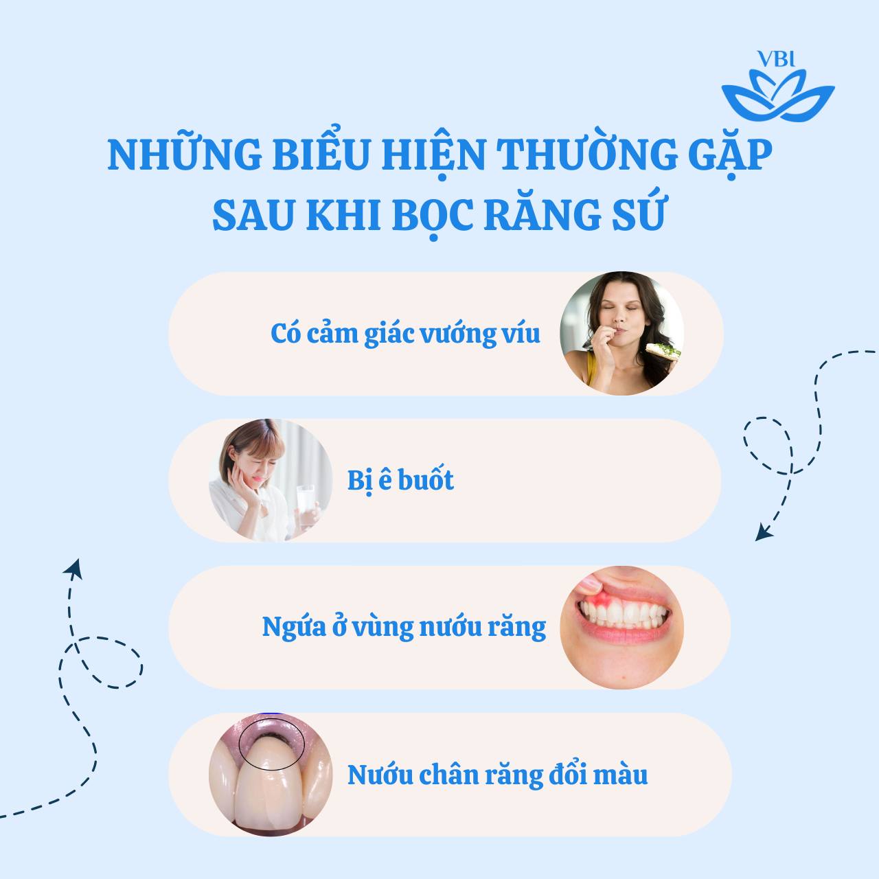 NHỮNG BIỂU HIỆN THƯỜNG GẶP SAU KHI BỌC RĂNG SỨ