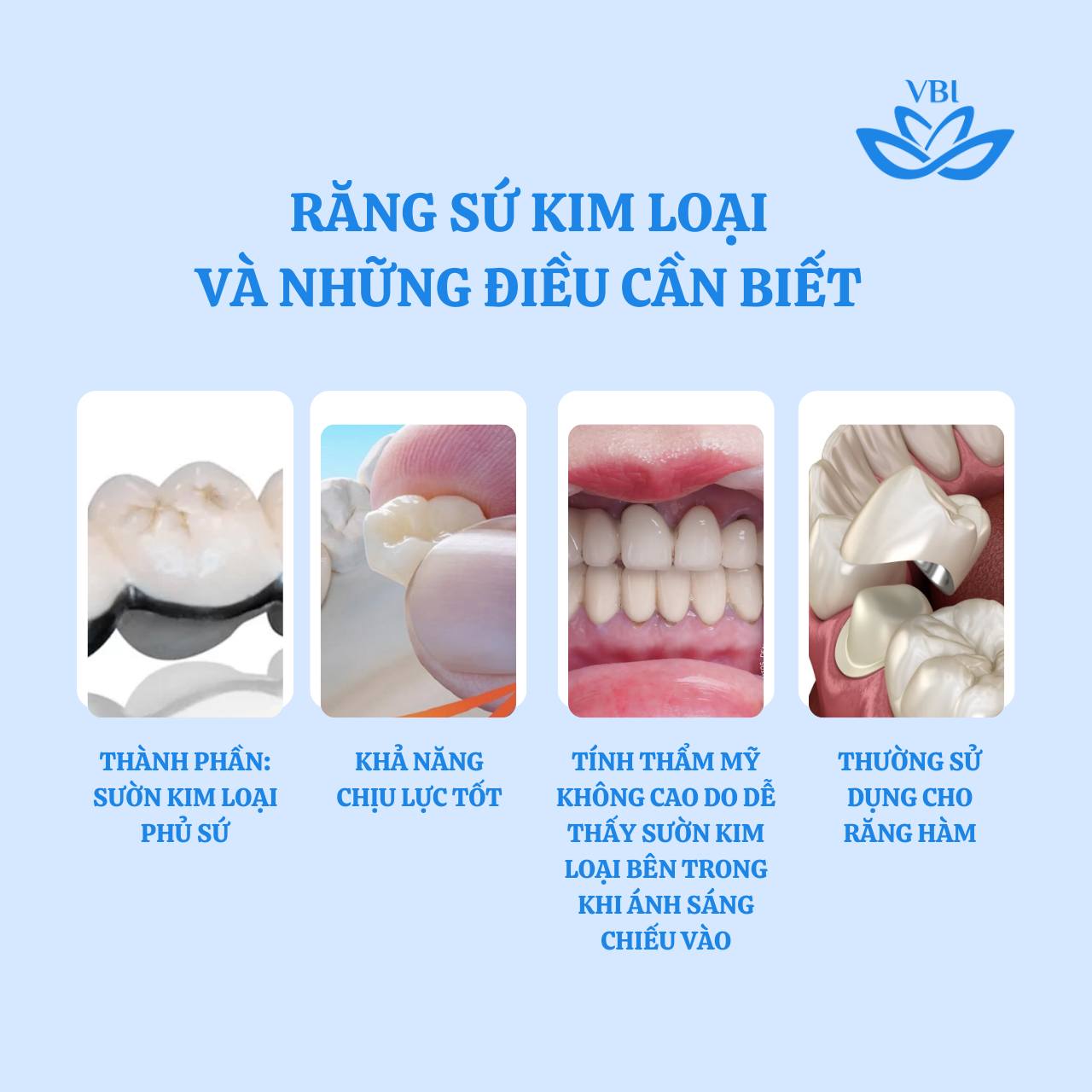 NHỮNG ĐIỀU CẦN BIẾT VỀ RĂNG SỨ KIM LOẠI