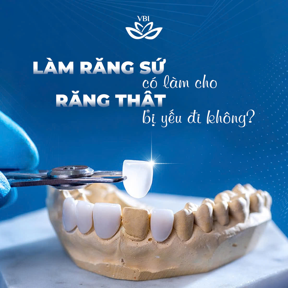 BỌC RĂNG SỨ CÓ LÀM RĂNG THẬT YẾU ĐI KHÔNG?