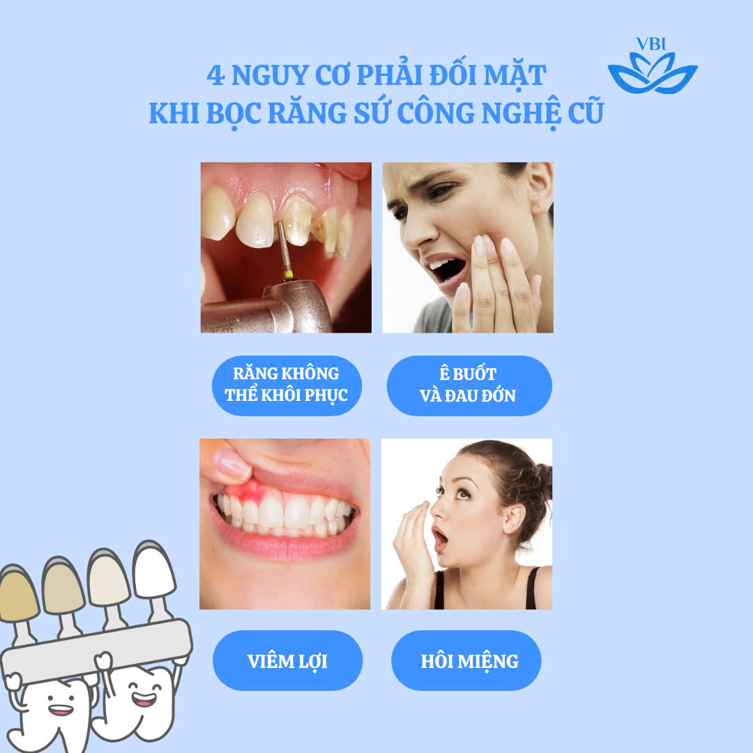 4 NGUY CƠ PHẢI ĐỐI MẶT KHI BỌC RĂNG SỨ CÔNG NGHỆ CŨ
