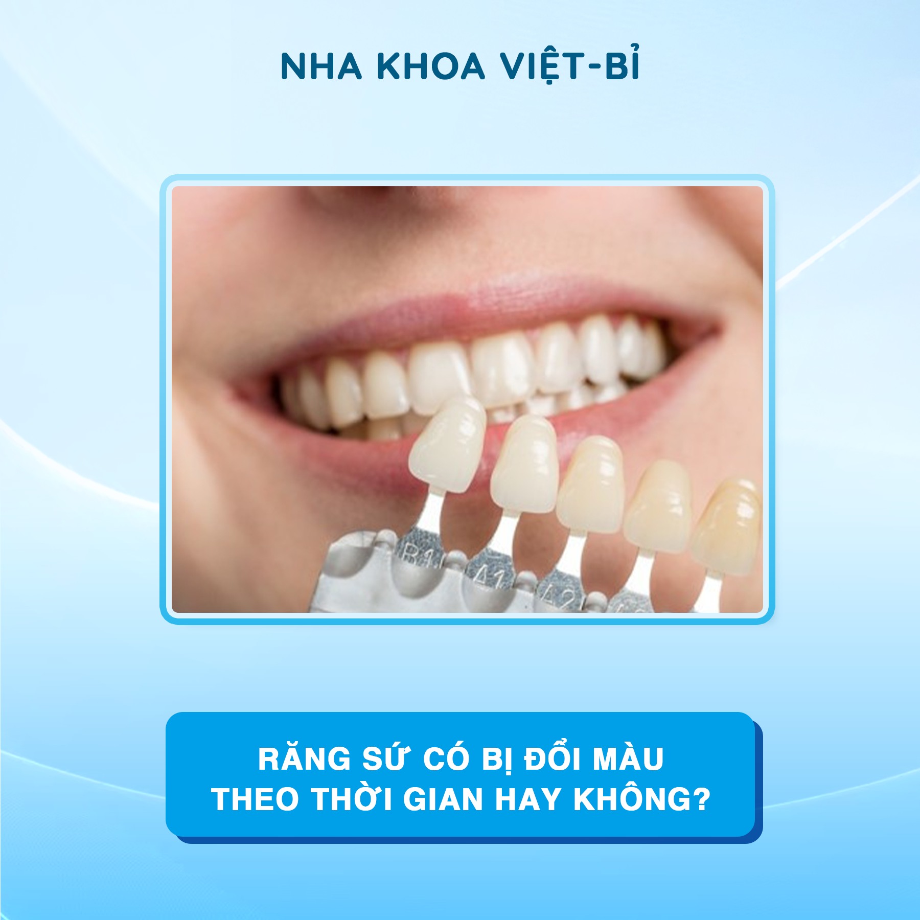 RĂNG SỨ CÓ BỊ ĐỔI MÀU THEO THỜI GIAN HAY KHÔNG