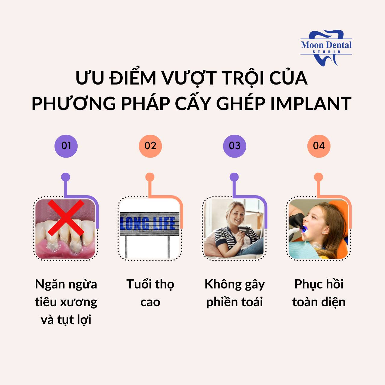 ƯU ĐIỂM VƯỢT TRỘI CỦA PHƯƠNG PHÁP CẤY GHÉP IMPLANT