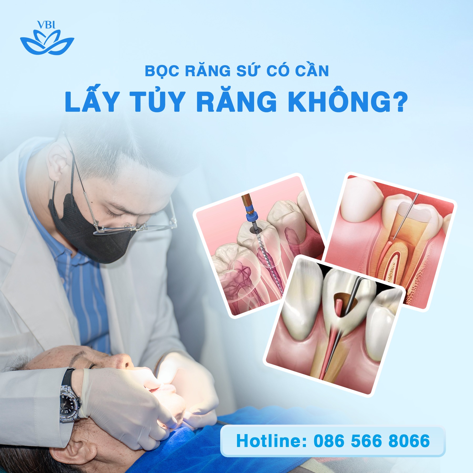 BỌC RĂNG SỨ CÓ CẦN LẤY TỦY RĂNG KHÔNG ❓❓❓