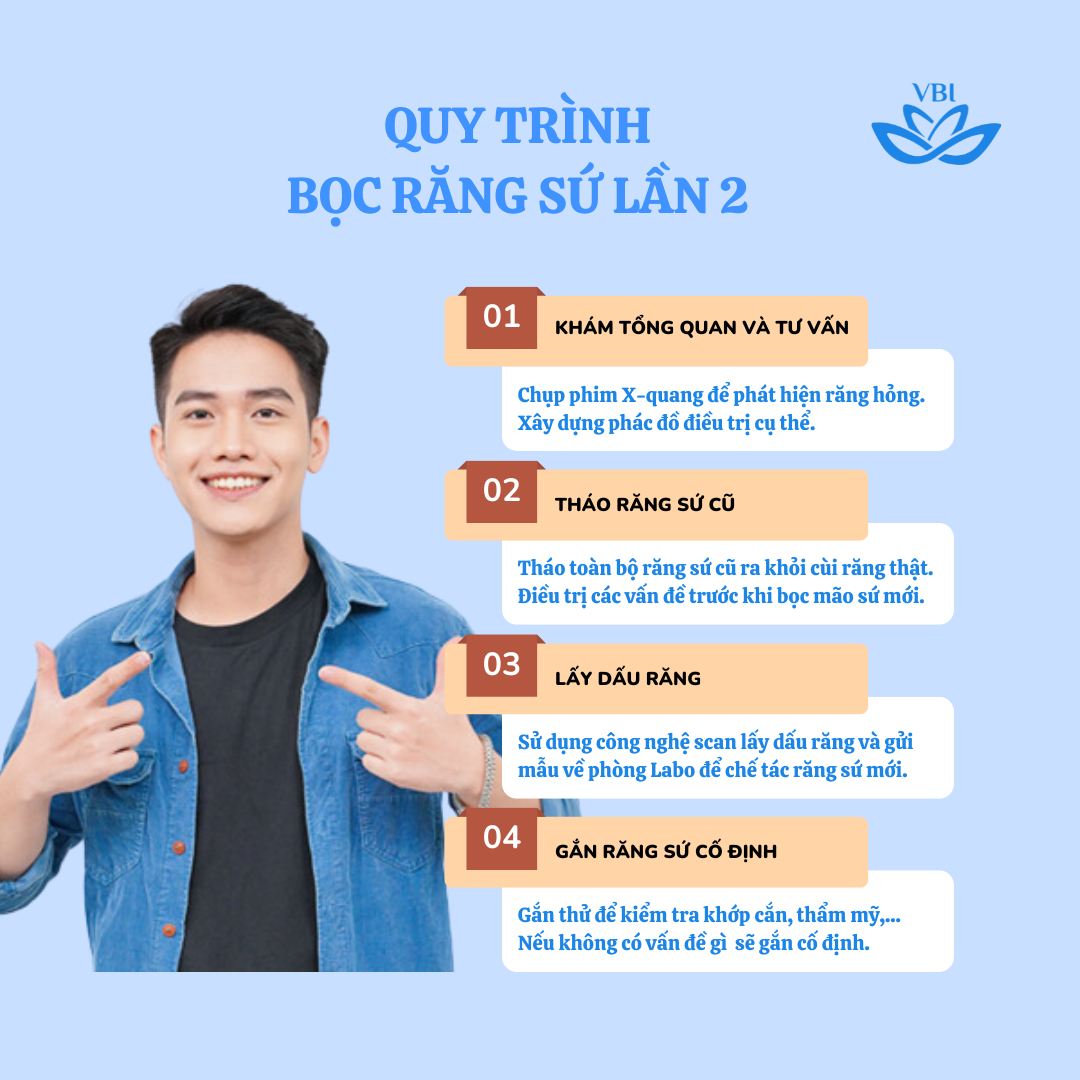 QUY TRÌNH BỌC RĂNG SỨ LẦN 2