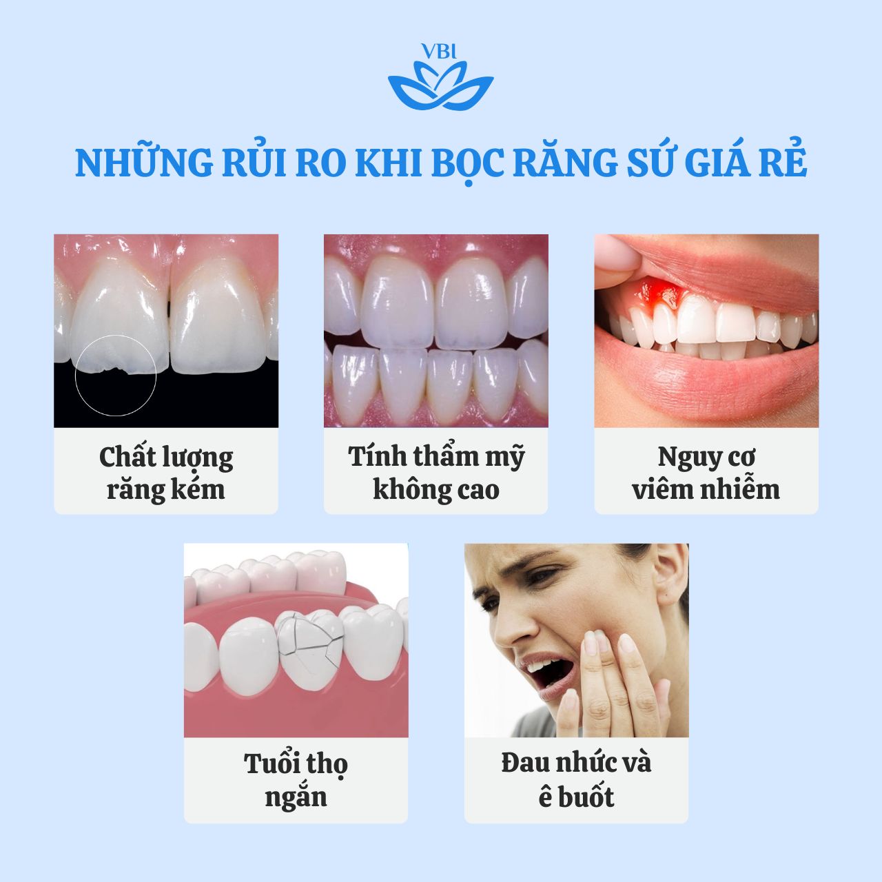 NHỮNG RỦI RO KHI BỌC RĂNG SỨ GIÁ RẺ