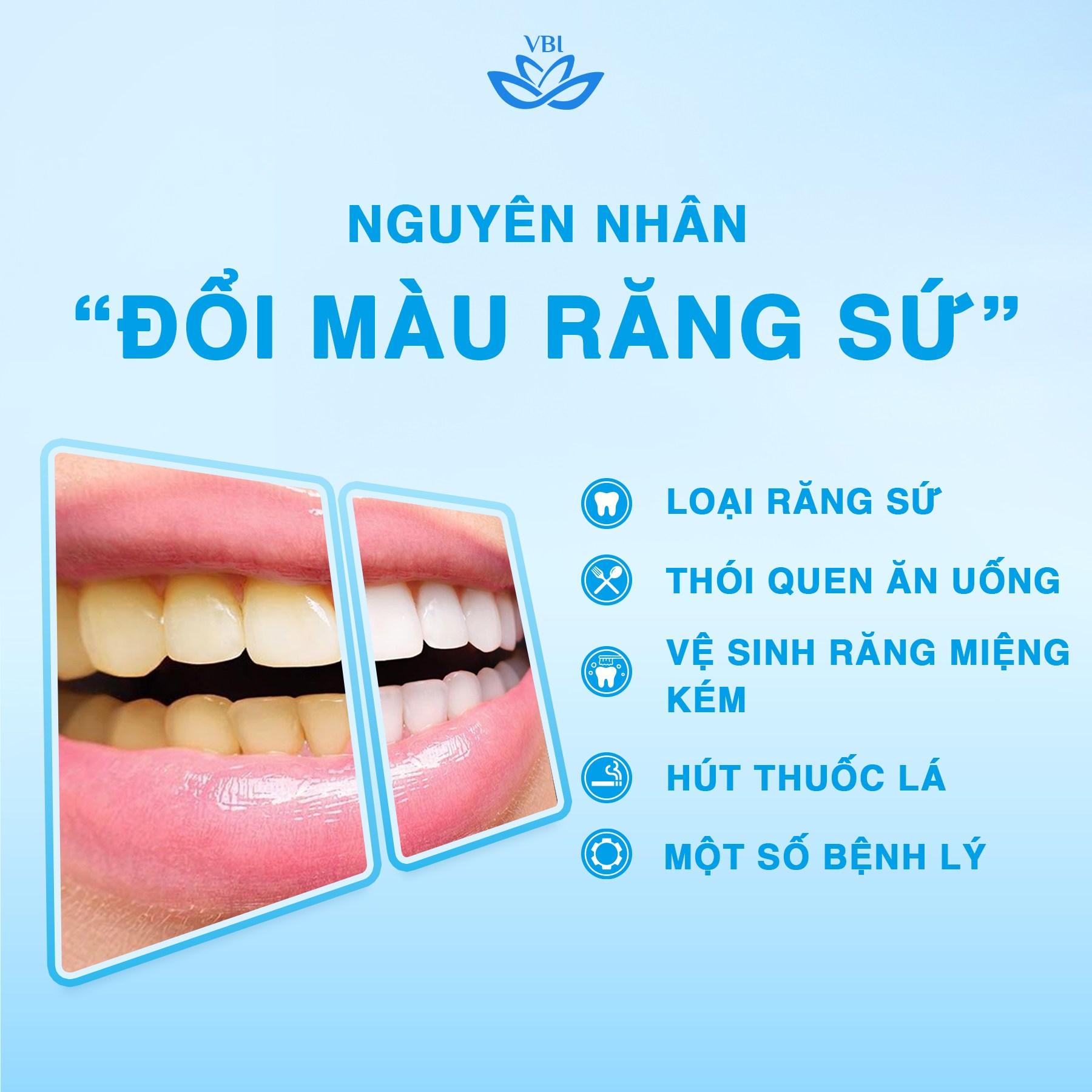 ❓NGUYÊN NHÂN KHIẾN RĂNG SỨ ĐỔI MÀU❓