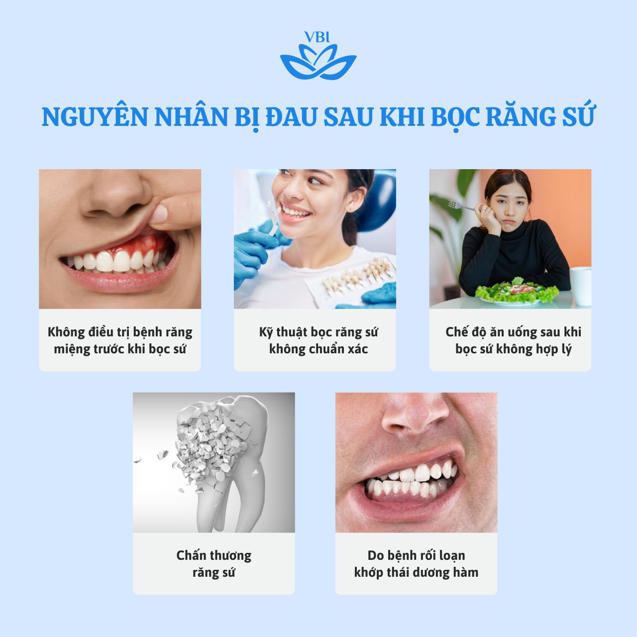 NGUYÊN NHÂN BỊ ĐAU SAU KHI BỌC RĂNG SỨ