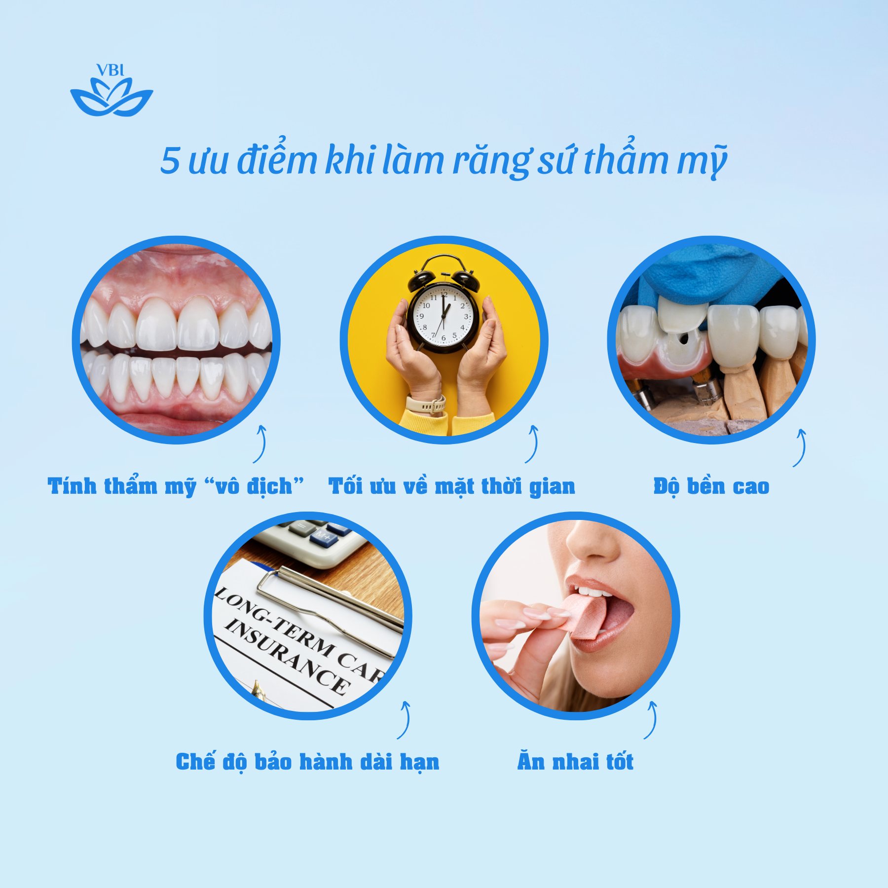5 ƯU ĐIỂM KHI LÀM RĂNG SỨ THẨM MỸ