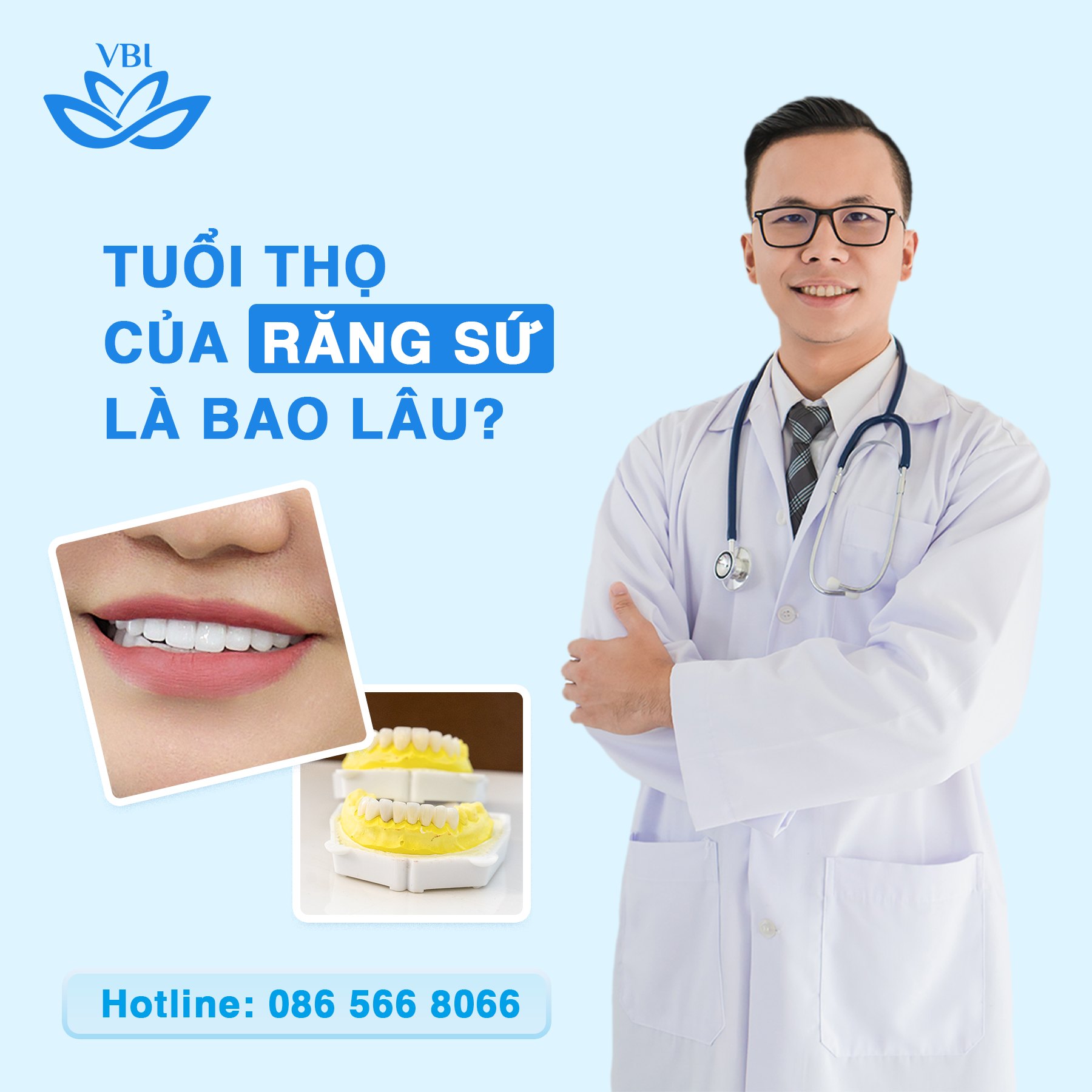 TUỔI THỌ CỦA RĂNG SỨ LÀ BAO LÂU ❓❓❓