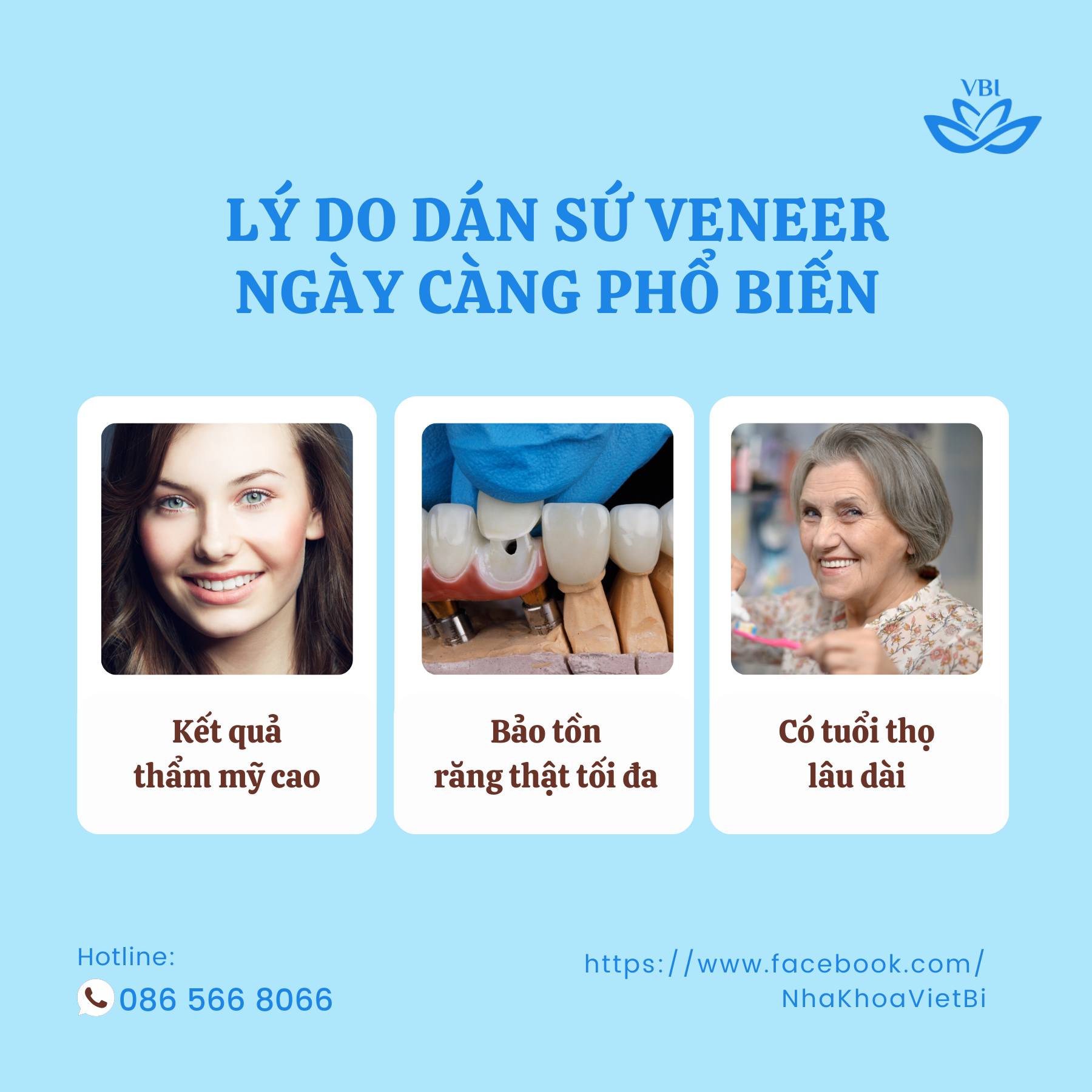 LÝ DO DÁN SỨ VENEER NGÀY CÀNG PHỔ BIẾN