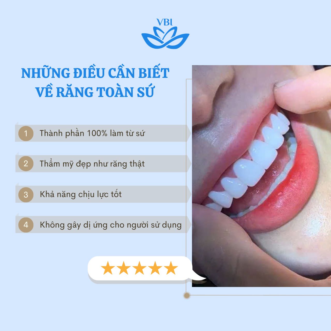 NHỮNG ĐIỀU CẦN BIẾT VỀ RĂNG TOÀN SỨ
