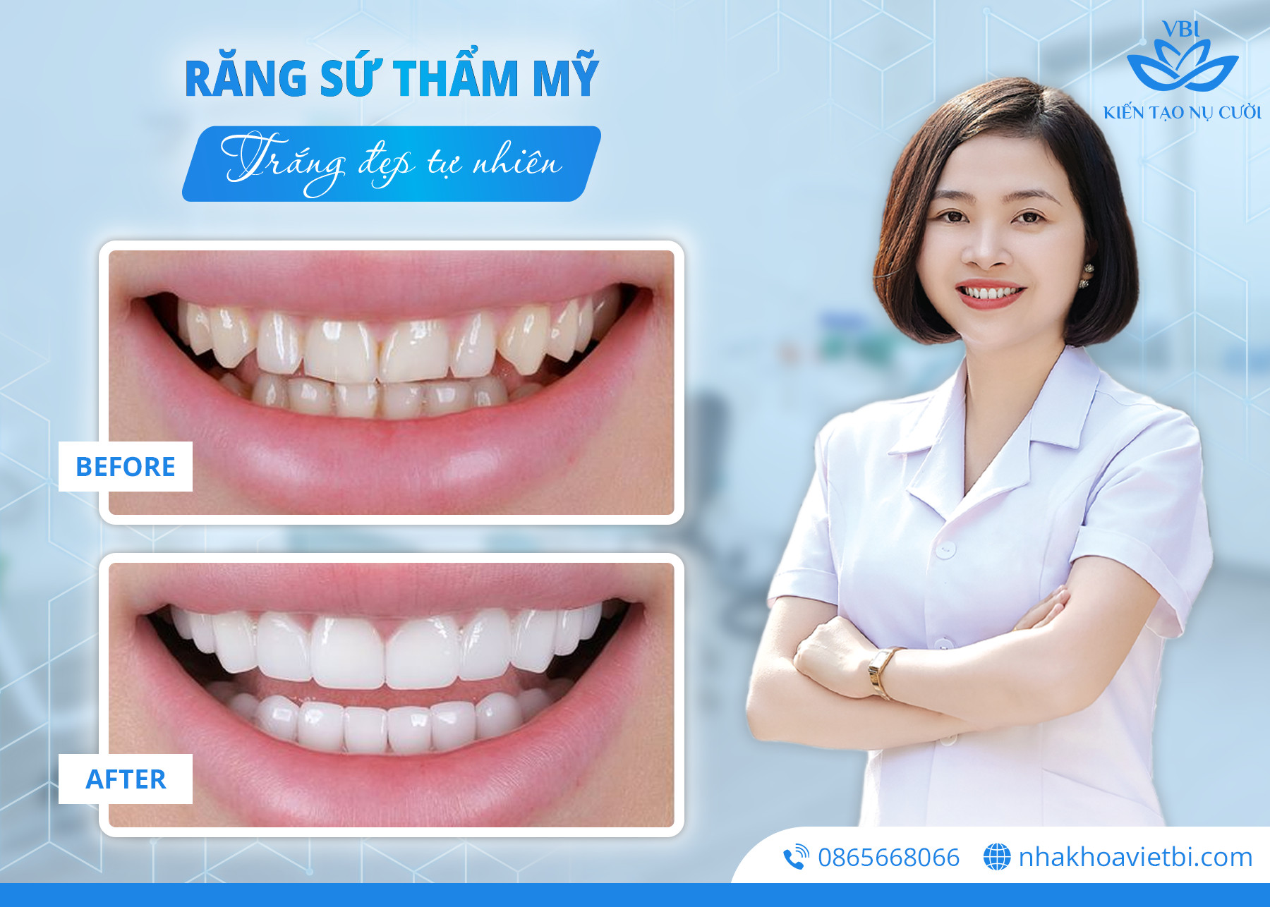  BÁC SĨ CKI. NGUYỄN THỊ THU HẰNG - NGƯỜI THỔI HỒN VÀO NHỮNG BỘ RĂNG SỨ TUYỆT MỸ TẠI NHA KHOA VIỆT BỈ 