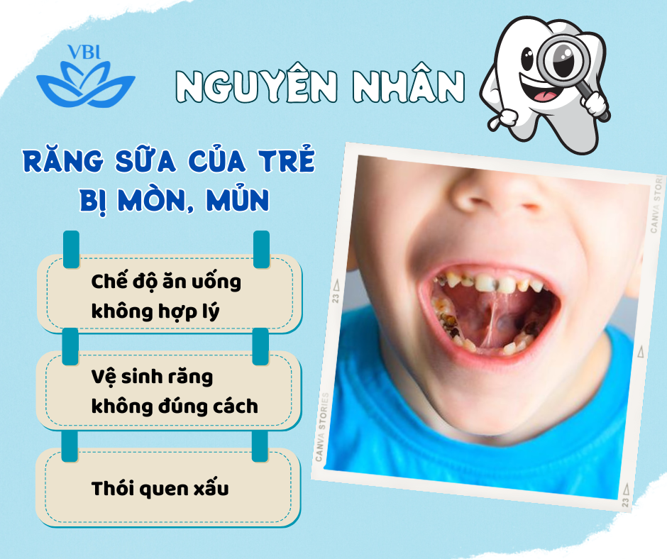 NGUYÊN NHÂN RĂNG SỮA CỦA TRẺ BỊ MÒN, MỦN