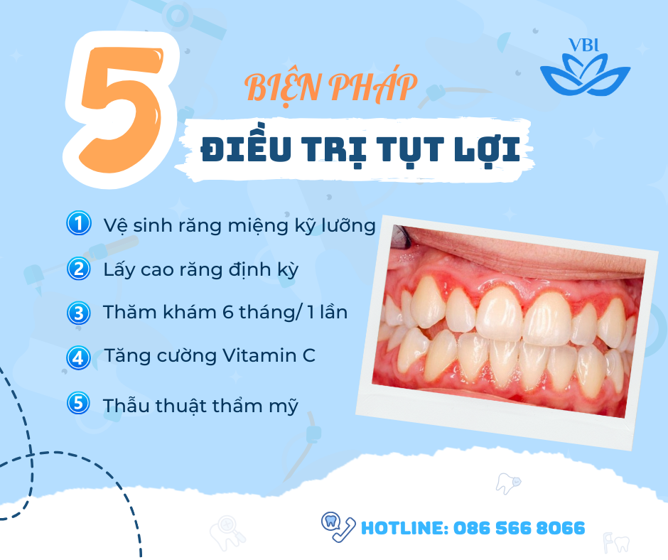5 BIỆN PHÁP HIỆU QUẢ ĐỂ TRIỆT TIÊU TÌNH TRẠNG TỤT LỢI