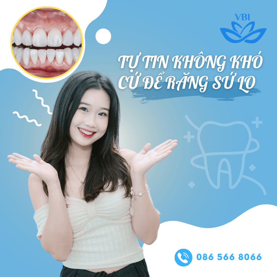 TỰ TIN KHÔNG KHÓ, CỨ ĐỂ RĂNG SỨ TẠI NHA KHOA VIỆT BỈ LO