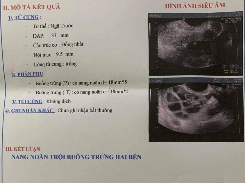 Chúc Mừng Bạn Đã Được Thăng Chức Mẹ Em Bé