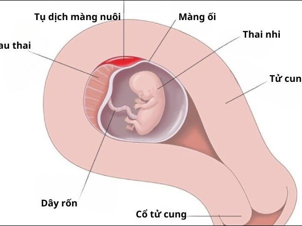 Tụ dịch màng nuôi là gì? Dấu hiệu, nguyên nhân và cách điều trị