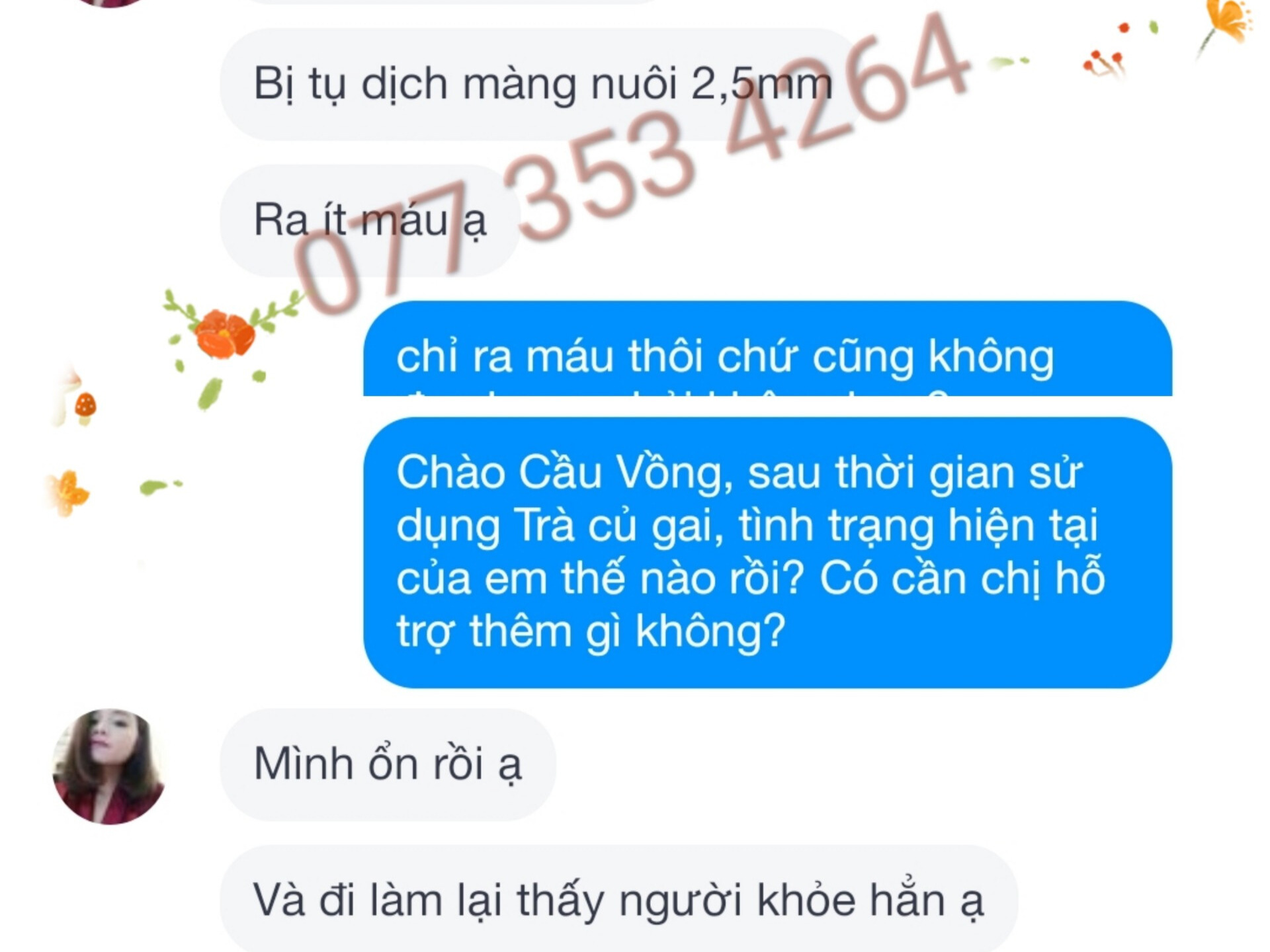 Tụ dịch màng nuôi 2,5mm - Khỏi ngay sau 1 liệu trình