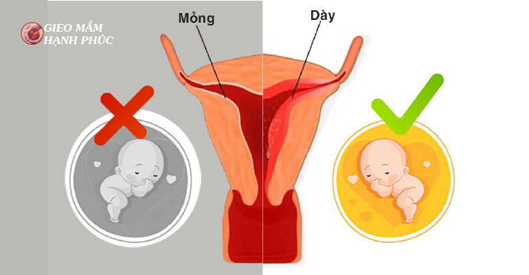 niêm mạc tử cung ảnh hưởng tới khả năng mang thai