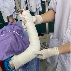 Đặc điểm nổi trội của việc sử dụng bột bó sợi thủy tinh