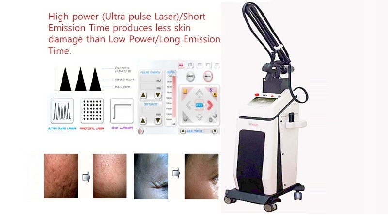 Máy Fractionnal Co2 Laser Pentagon