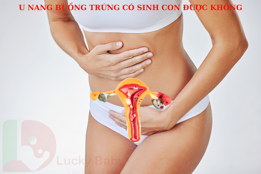 U NANG BUỒNG TRỨNG CÓ SINH CON ĐƯỢC KHÔNG?