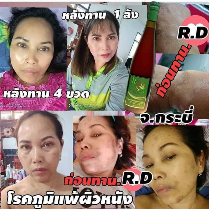 RD Fresh Plus Nước Hoa Quả Enzyme Thái Lan