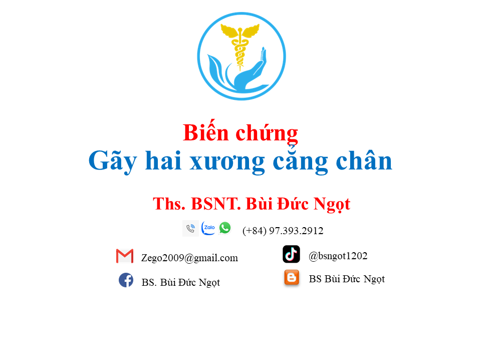 Biến chứng gãy 2 xương cẳng chân