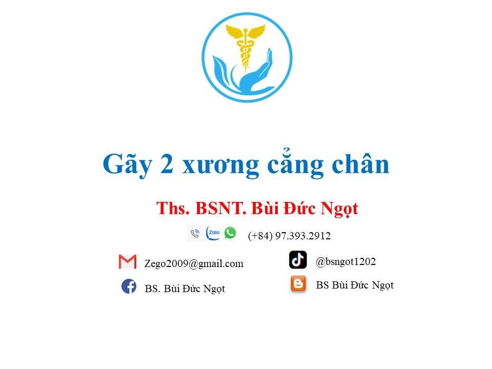 Gãy 2 xương cẳng chân