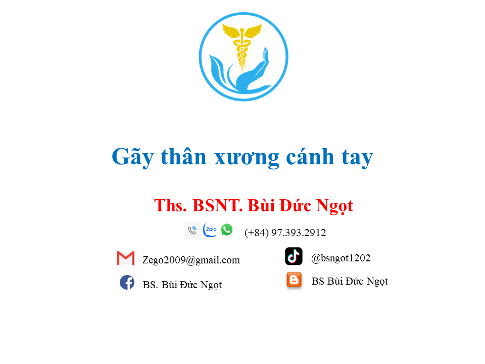 Gãy thân xương cánh tay