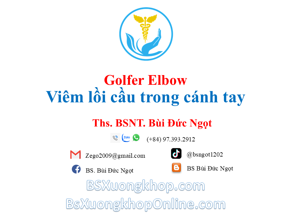 Golfer Elbow - Viêm lồi cầu trong cánh tay