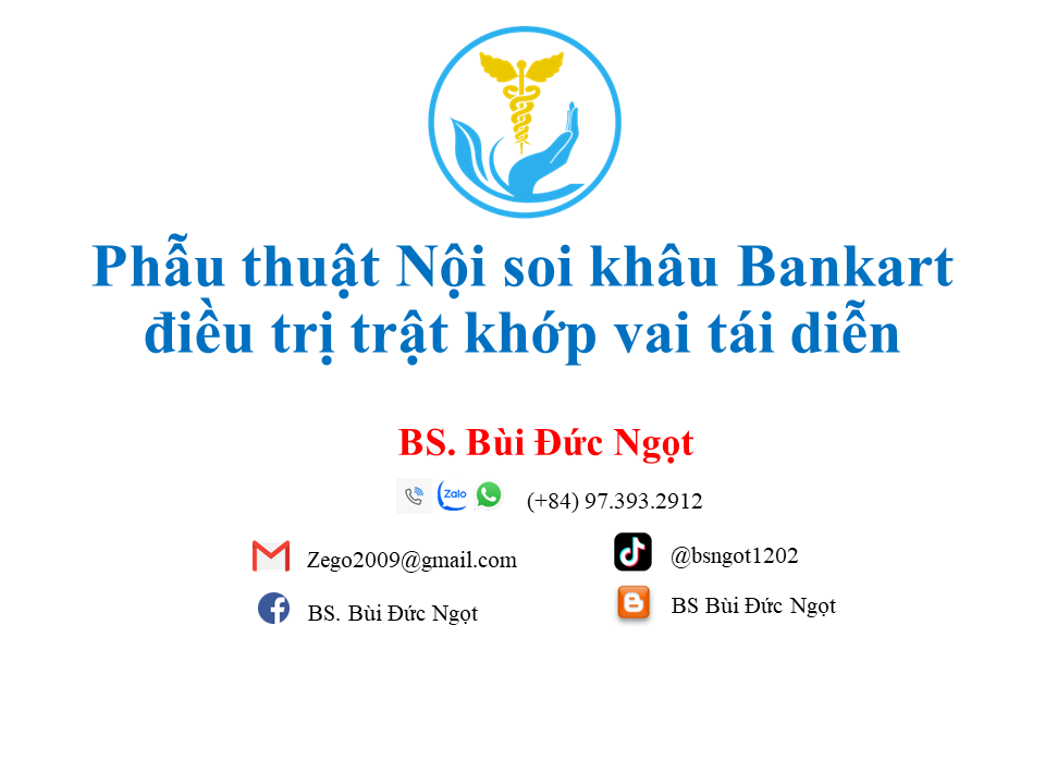 Mổ Nội soi khớp vai khâu Bankart điều trị trật khớp vai tái diễn