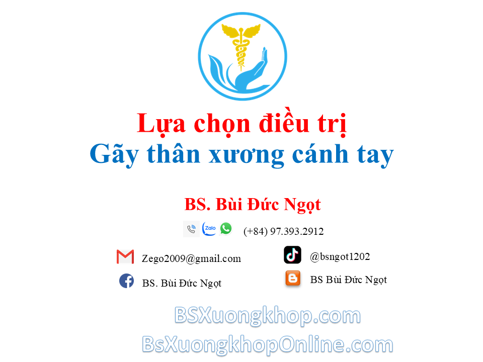 Lựa chọn điều trị gãy thân xương cánh tay