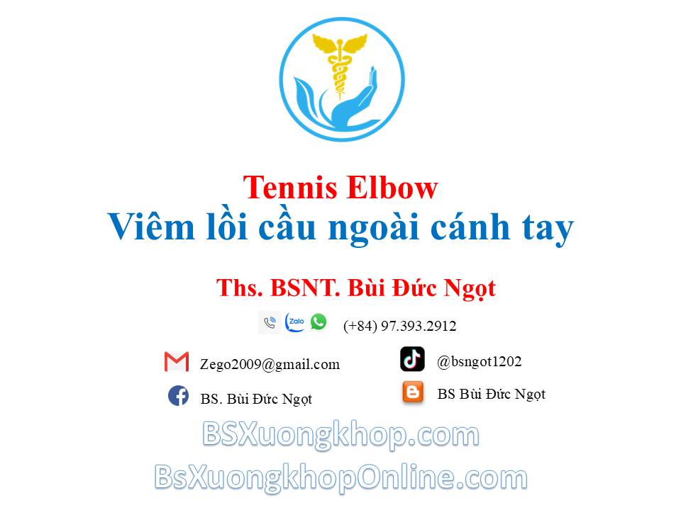 Tennis Elbow - Bệnh lý viêm lồi cầu ngoài cánh tay