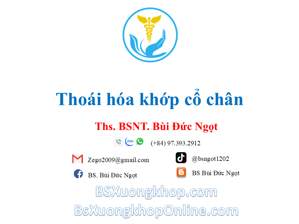 Thoái hóa khớp cổ chân: Nguyên nhân, triệu chứng & điều trị