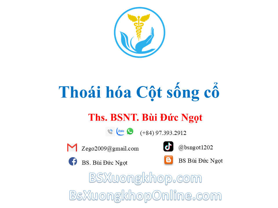 Thoái hóa đốt sống cổ là gì? Nguyên nhân, triệu chứng & điều trị