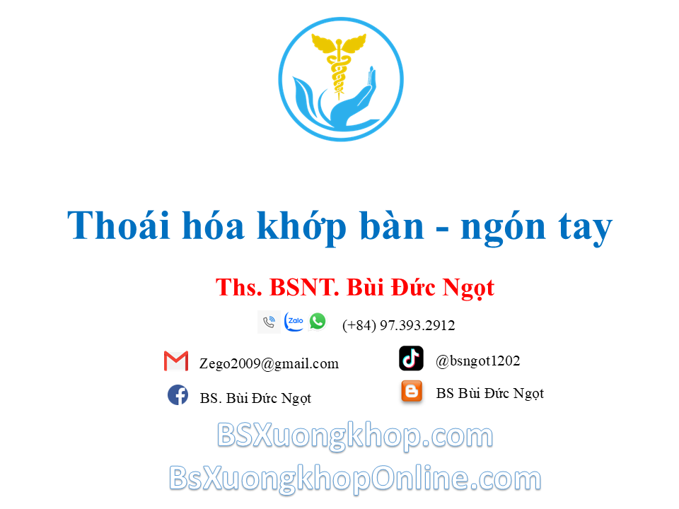 Thoái hóa khớp bàn tay là gì? Nguyên nhân & cách điều trị hiệu quả