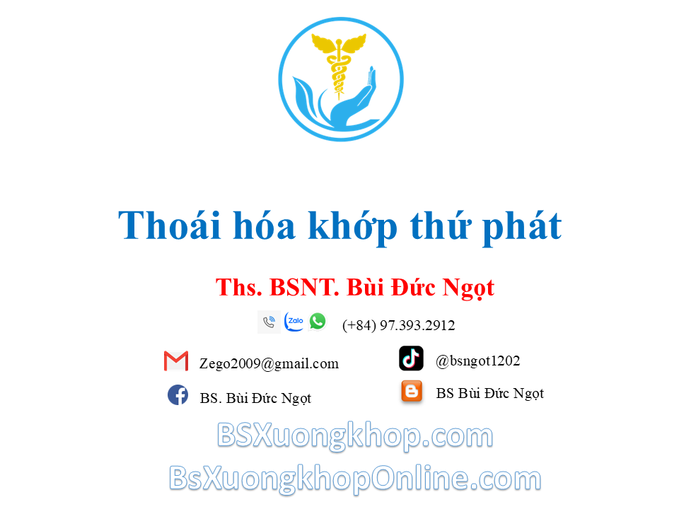 Thoái hóa khớp thứ phát là gì? Nguyên nhân & cách điều trị