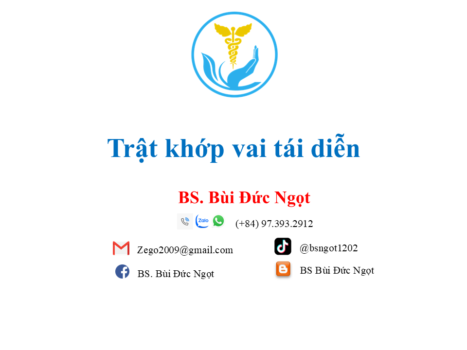 Trật khớp vai tái diễn