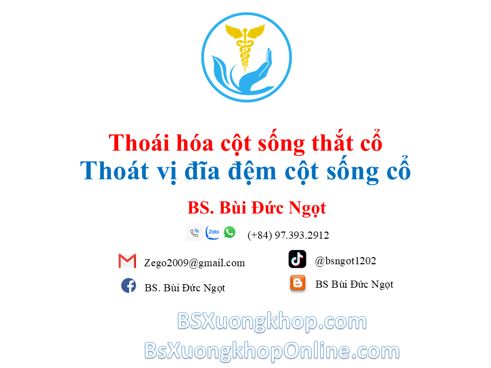Thoát vị đĩa đệm cột sống cổ là gì? Nguyên nhân & điều trị