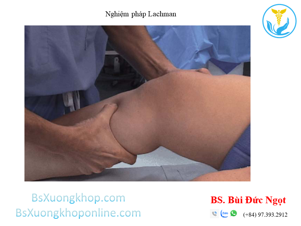 Nghiệm pháp Lachman