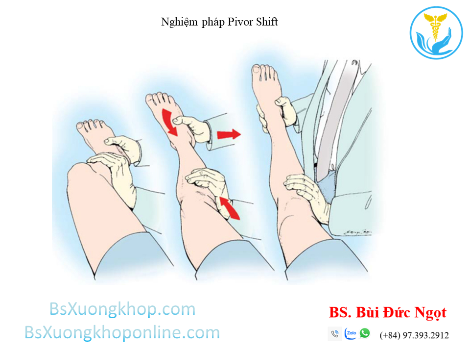 Nghiệm pháp Lachman