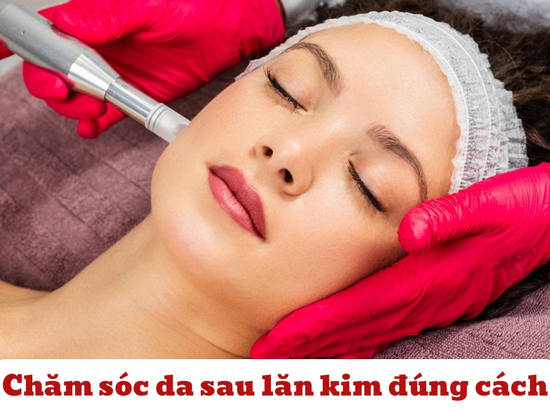 Chăm sóc da sau lăn kim đúng cách: Bí quyết phục hồi nhanh