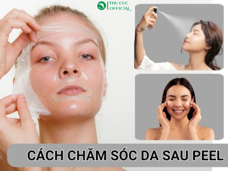 Hướng dẫn chăm sóc da sau peel đúng cách - Da phục hồi nhanh