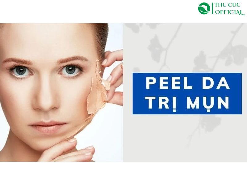 Peel da trị mụn: Giải pháp hiệu quả cho da mụn viêm, mụn ẩn