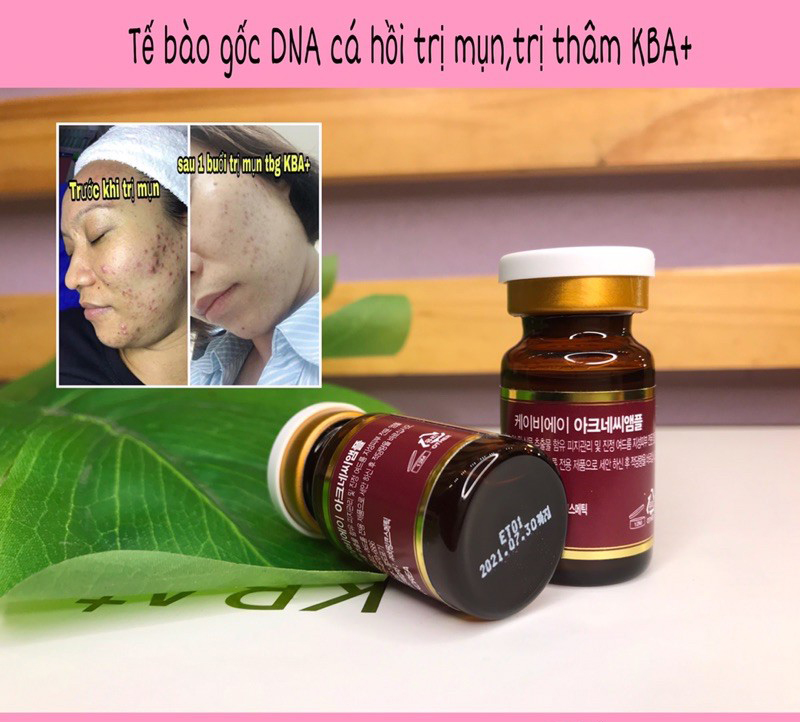 KBA+ DNA cá hồi Acne Ampoule 